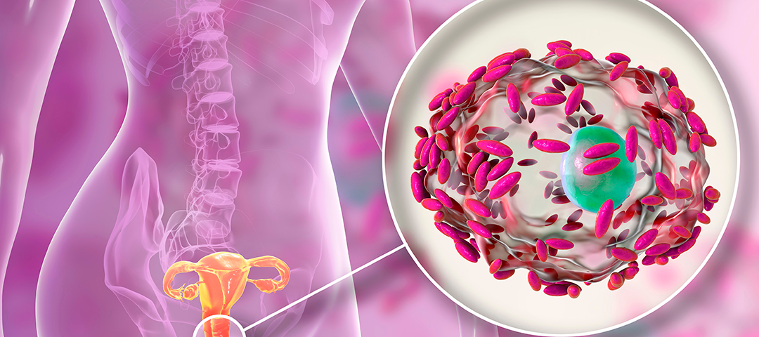 PAINEL/ PCR VAGINOSE BACTERIANA