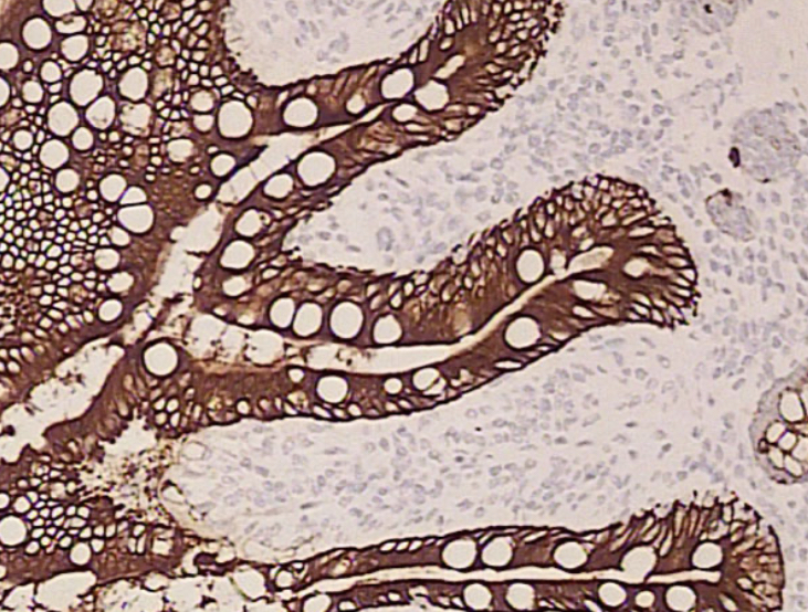 Imunohistoquímica painel ou reagente isolado