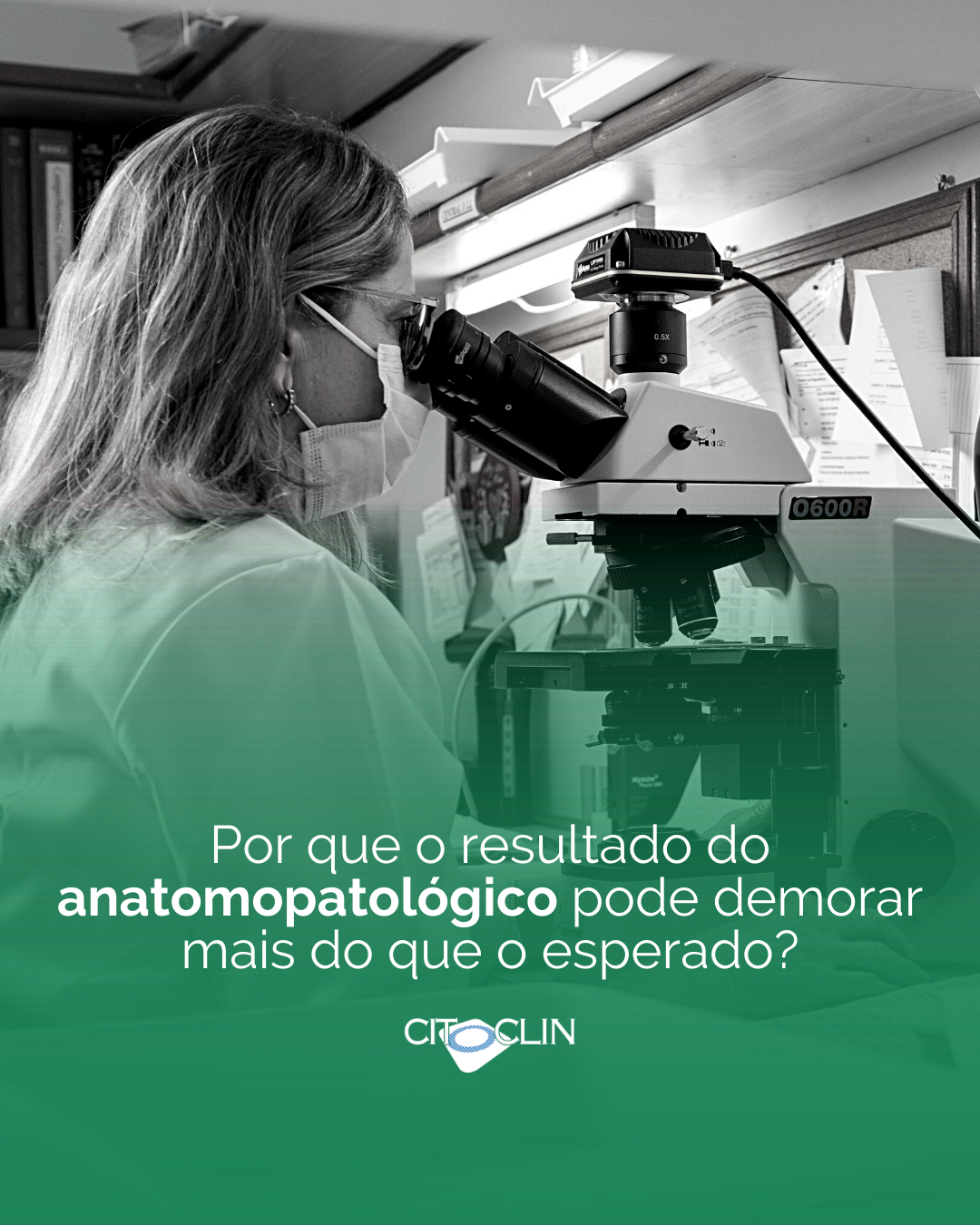 Por que o resultado do anatomopatológico pode demorar mais do que o esperado?