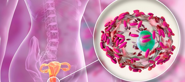 Imagem de PAINEL/ PCR VAGINOSE BACTERIANA