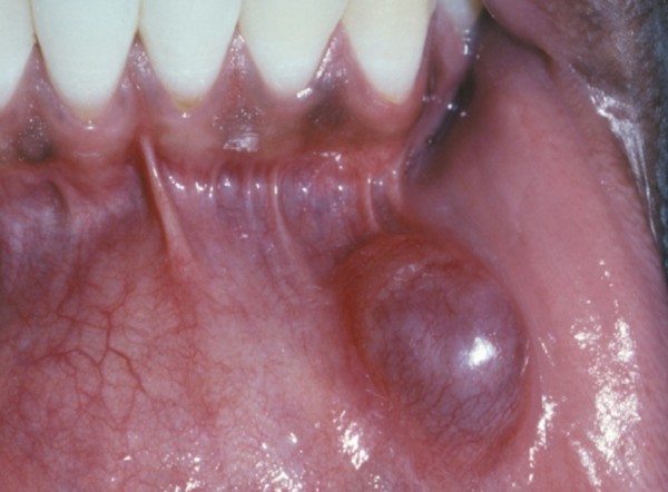 Imagem do procedimento Patologia bucal