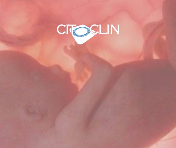 Imagem do procedimento Necropsia de feto até 500g