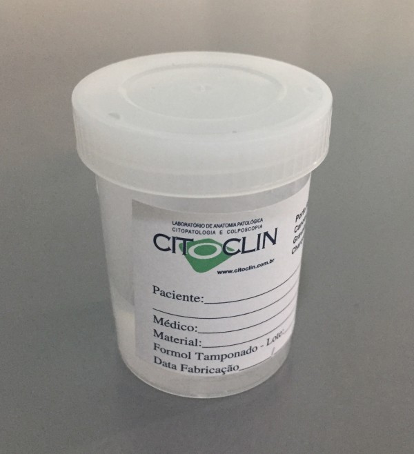 Como conservar materiais coletados para exames citopatológicos e anatomopatológicos para enviar ao l