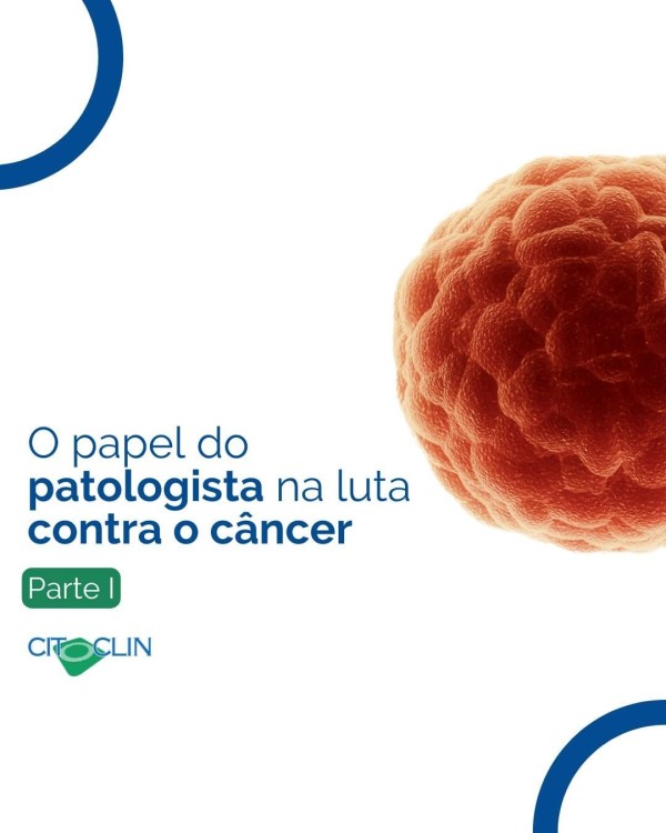 O papel do Patologista na luta contra o câncer - Parte 1