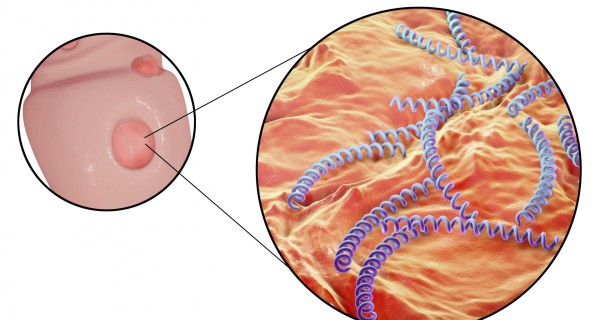 Imagem de PAINEL/ PCR ÚLCERA GENITAL