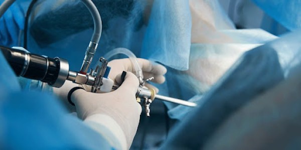 Agora o Citoclin realiza histeroscopia ambulatorial diagnóstica: mais conforto e precisão em um só e